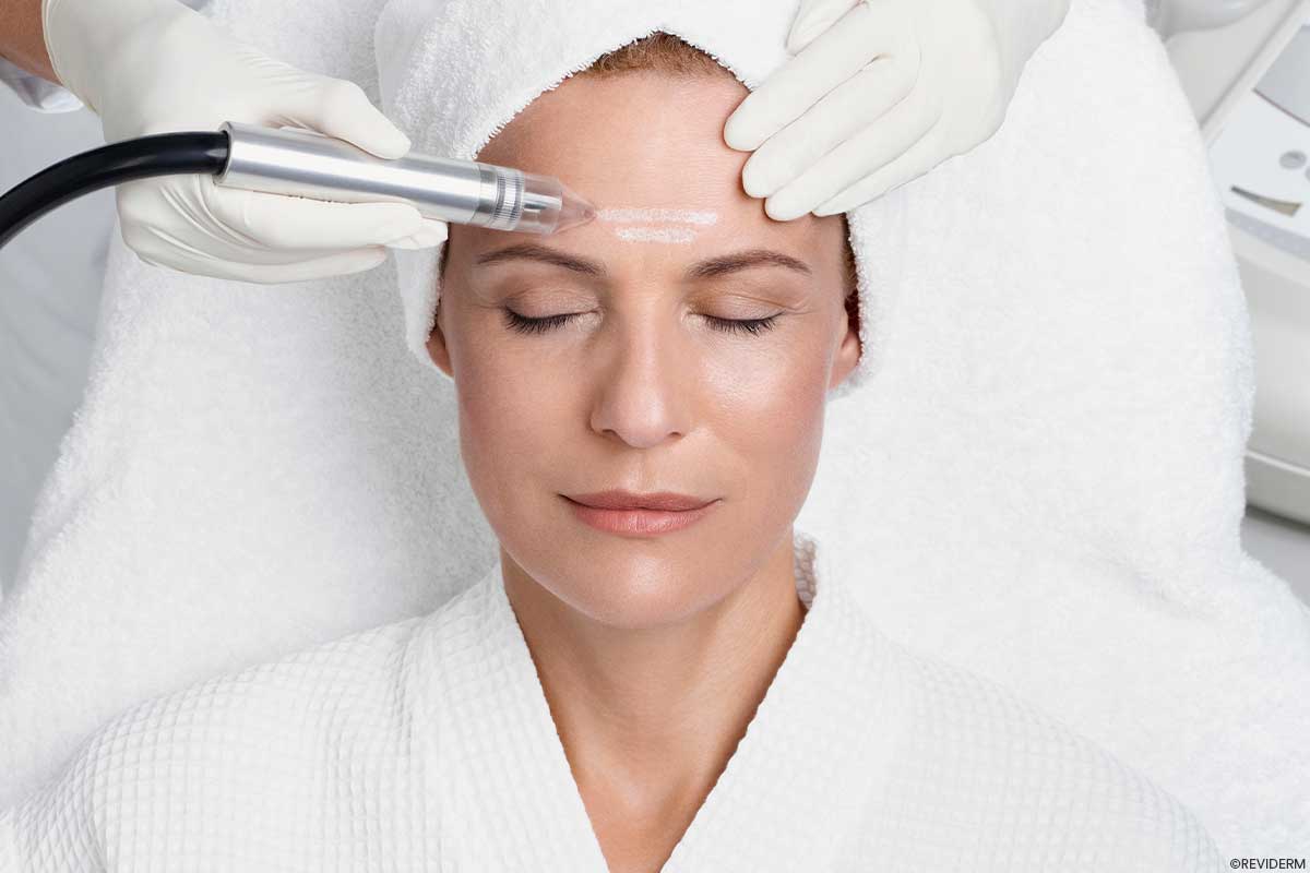 microdermabrasion behandlung